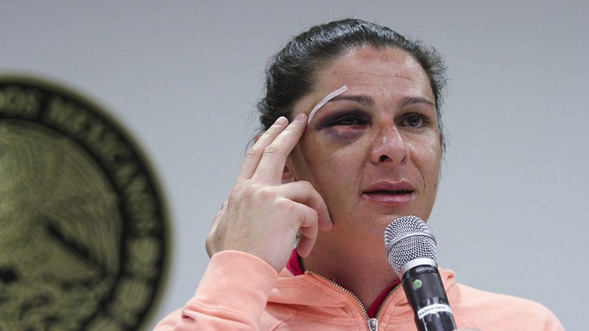 Ana Guevara llega a acuerdo con su agresor