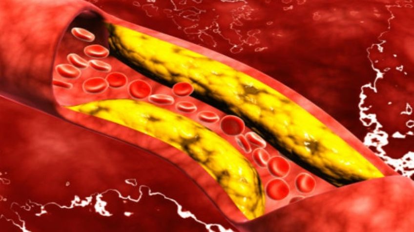 Los tipos de colesterol: ¿Cuál es el bueno y el malo?
