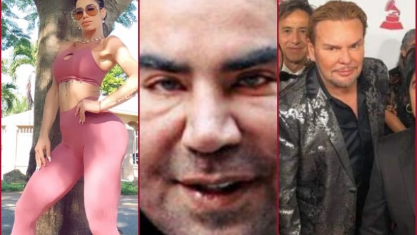 10 personas que quedaron peor que Alejandra Guzmán con tanta cirugía: FOTOS