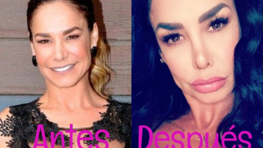 Así dejaron las cirugías y el botox a Liz Vega: FOTO