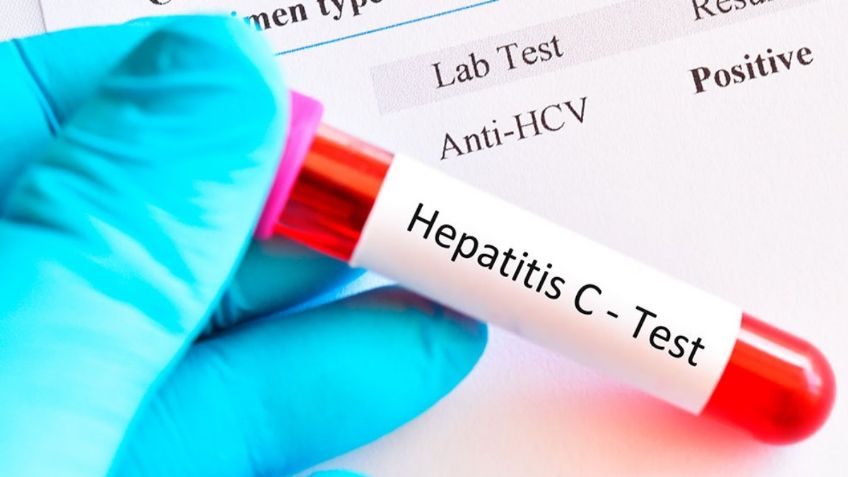 Hepatitis: Conoce los 5 diferentes tipos que afectan al hígado