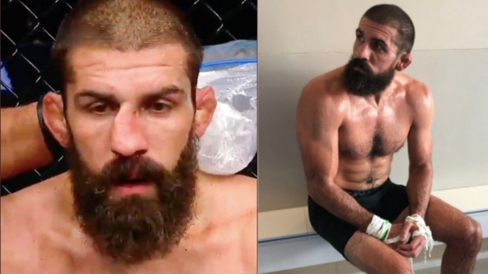 Peleador de la UFC se rompe la nariz FOTO Twitter Court_McGee