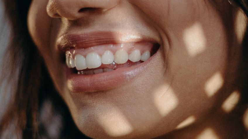 ¿Por qué apretamos los dientes al dormir? Conoce este síndrome que pone en riesgo tu salud