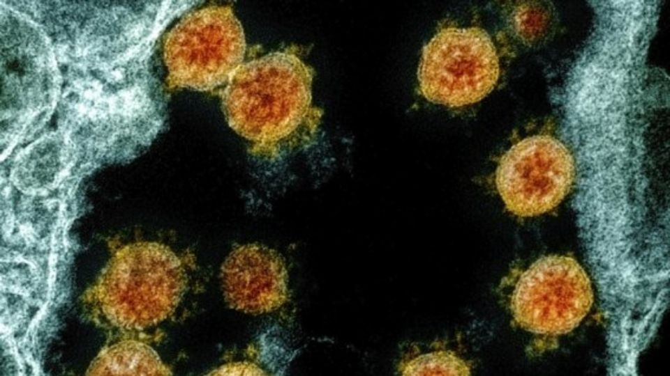 El nuevo virus duraría más en superficies, que en la piel. Foto: AP