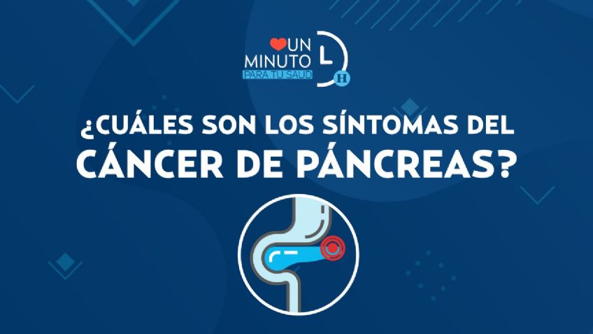 ¿Cuáles son los síntomas del cáncer de páncreas?