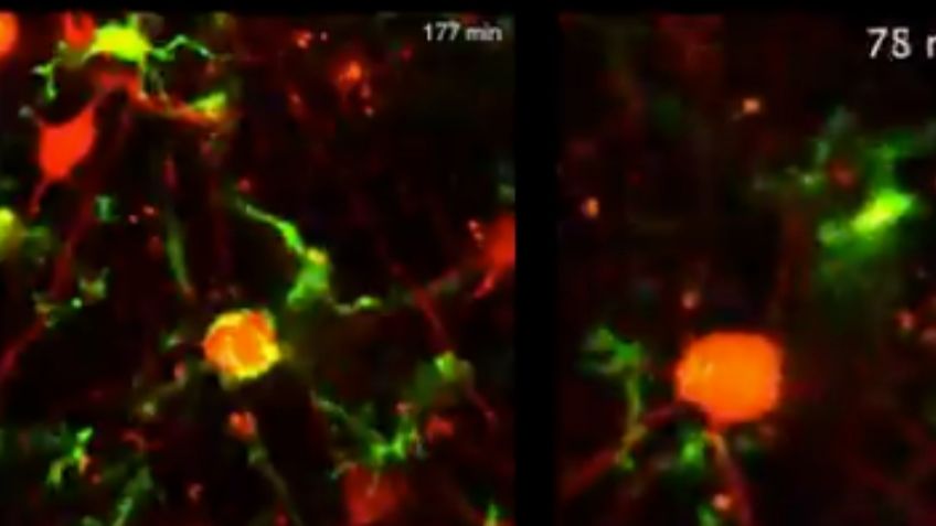 ¡Increíble! Científicos captan limpieza del cerebro de neuronas muertas: VIDEO