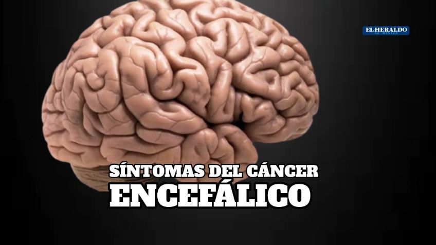 ¿Cómo empieza el cáncer en la cabeza, cuáles son los síntomas de un tumor cerebral?