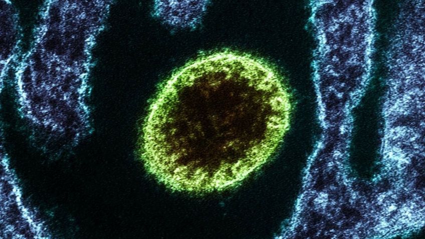 Esto es lo que sabemos de Nipah, el virus que podría desbancar al Covid-19