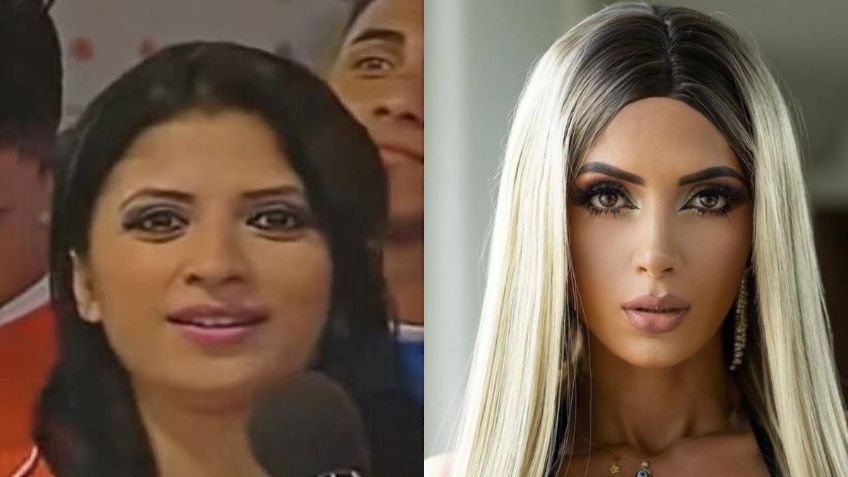 Así se veía Kimberly Flores ANTES de sus drásticos arreglos estéticos: FOTOS