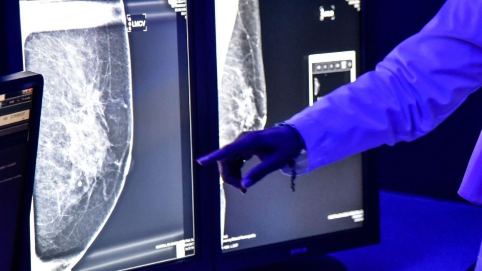 En el mundo 2.2 millones de casos nuevos de cáncer de mama (Foto: Cuartoscuro)