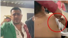 VIDEO: Momento exacto en que atacan a balazos a gruperos en Chimalhuacán