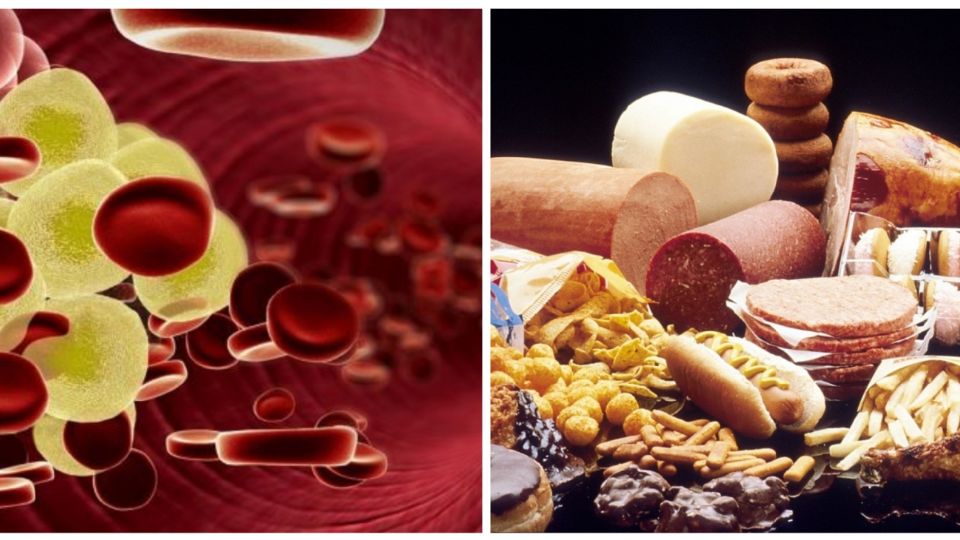 ¿Qué alimentos se deben evitar para eliminar el colesterol en la sangre?
FOTO: Especial