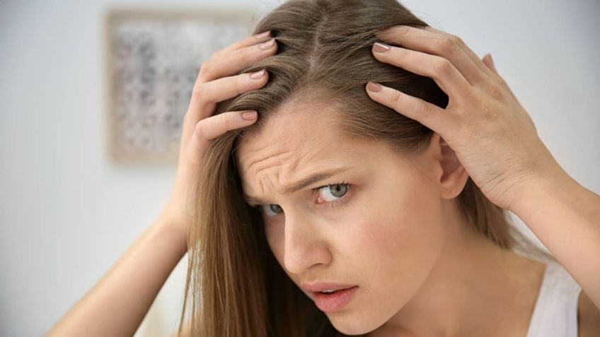 Dermatólogos revelan que el Covid-19 puede causar pérdida de cabello