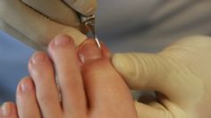 Uñas: 3 trucos para evitar que se te encarnen