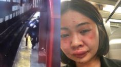 Modelo tailandesa es atacada brutalmente en NY; acusan ataque racial