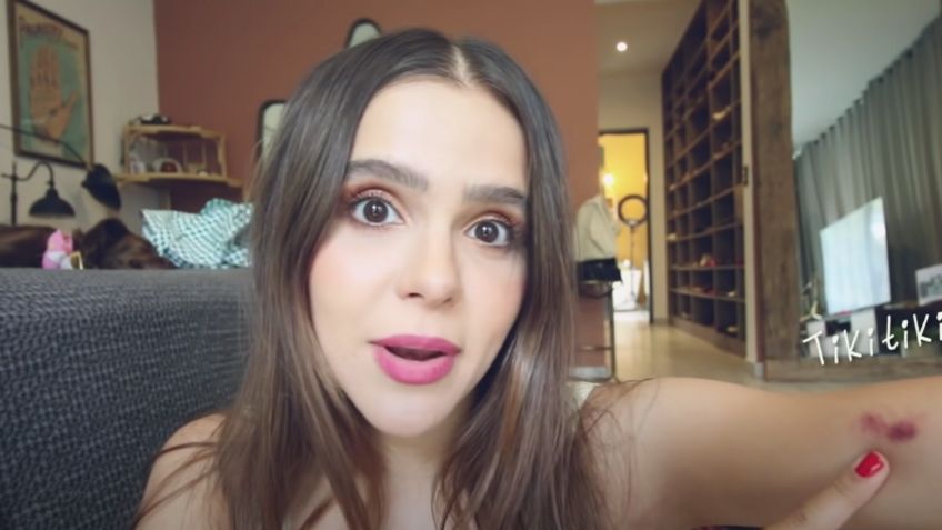 ¿Qué le pasó a YUYA? La influencer muestra MORETONES y causa alerta | VIDEO