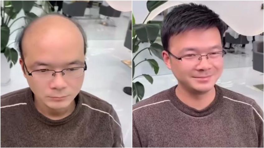 ¡Impactante! En China ponen cabello postizo a HOMBRES con esta RARA tecnología: VIDEO