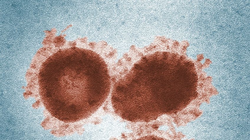 ÚLTIMA HORA CORONAVIRUS: Se podrá matar al virus con ultrasonidos