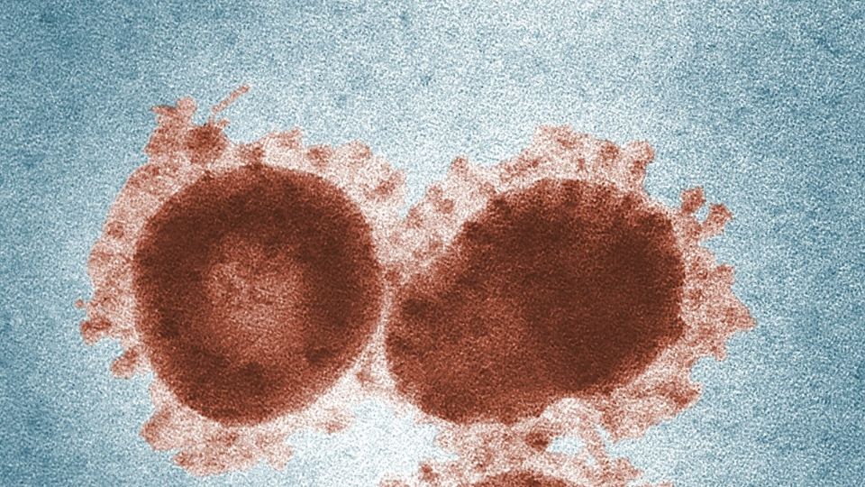 Los ultrasonidos podrían servir como tratamiento para combatir al coronavirus.