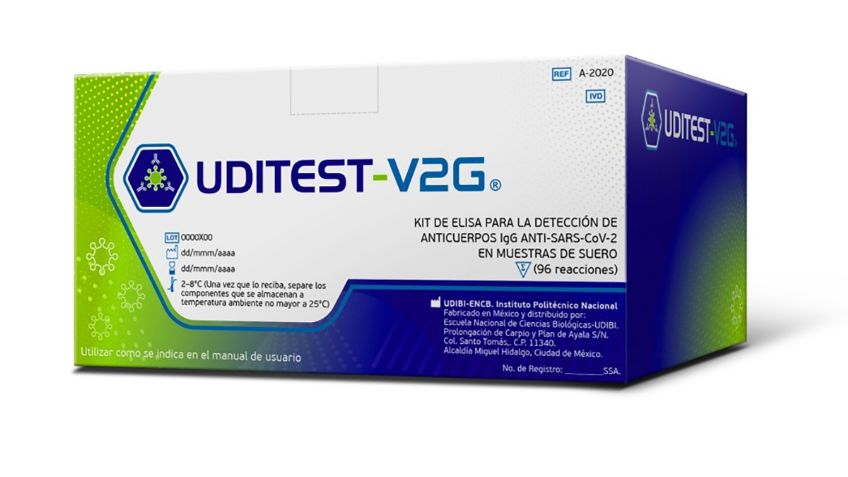 IPN desarrolla primer kit mexicano para detectar anticuerpos contra Covid-19