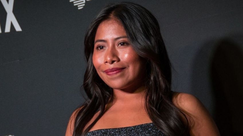 Yalitza Aparicio: ¿En qué consiste la enfermedad que ha cambiado su rostro?