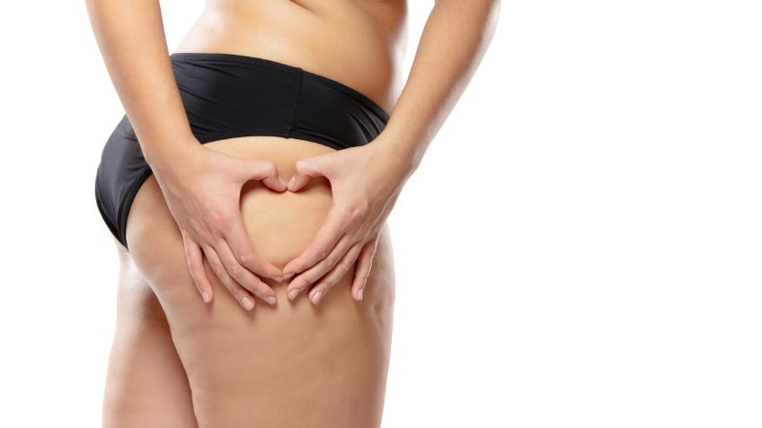 ¿Cómo disminuir la celulitis en las piernas? 4 remedios caseros infalibles