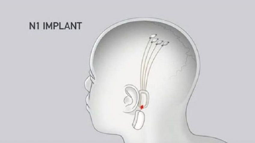 NEURALINK: Llegó la hora de implantar chips cerebrales de inteligencia artificial en humanos