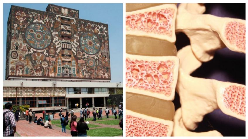 UNAM crea parche contra la osteoporosis; será sustituto de las pastillas