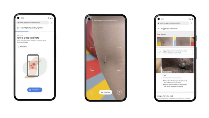 Google lanza app que ayuda a identificar problemas en la piel con la cámara de tu celular