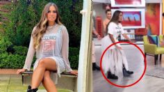 ¿Qué le pasó? Galilea Montijo REAPARECE en Hoy con fuerte lesión