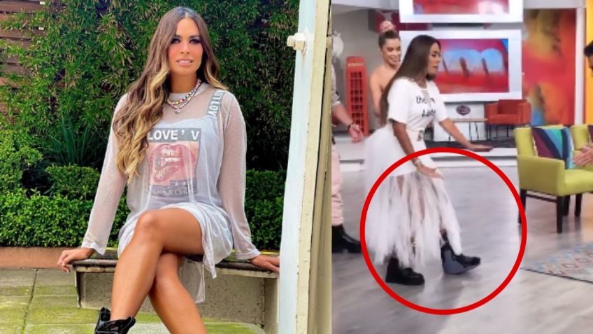 ¿Qué le pasó? Galilea Montijo REAPARECE en Hoy con fuerte lesión