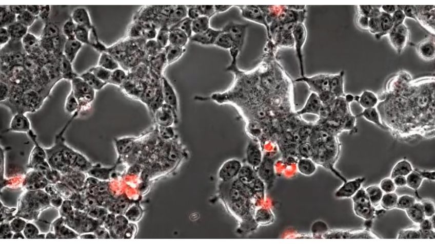 Impactante: Este video microscópico muestra cómo el coronavirus se infiltra en el cerebro