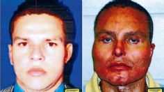 El Chupeta: El narcogalán colombiano que quedó desfigurado y testificó contra El Chapo