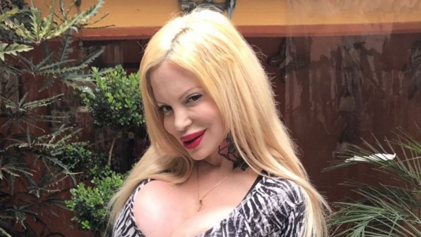 Sabrina Sabrok perdió movilidad en esta parte de su cuerpo por ¿exceso de cirugías?