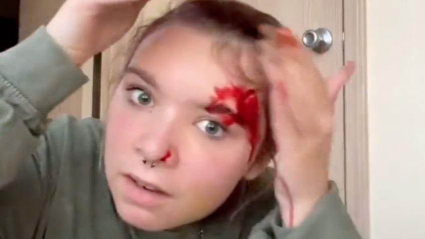 Joven se corta el rostro con un cuchillo al intentar realizar peligroso reto viral: TikTok elimina los videos