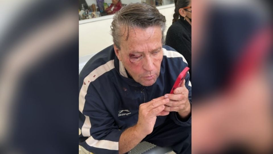 El actor fue golpeado durante una persecución que terminó con la vida de un policía de la CDMX.