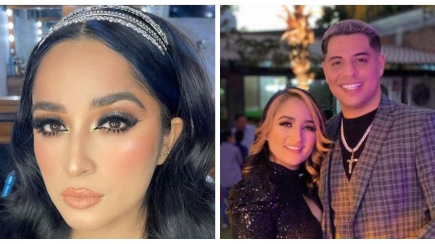 Daisy Anahy, esposa de Eduin Caz revela una foto con el antes y después de su cirugía facial