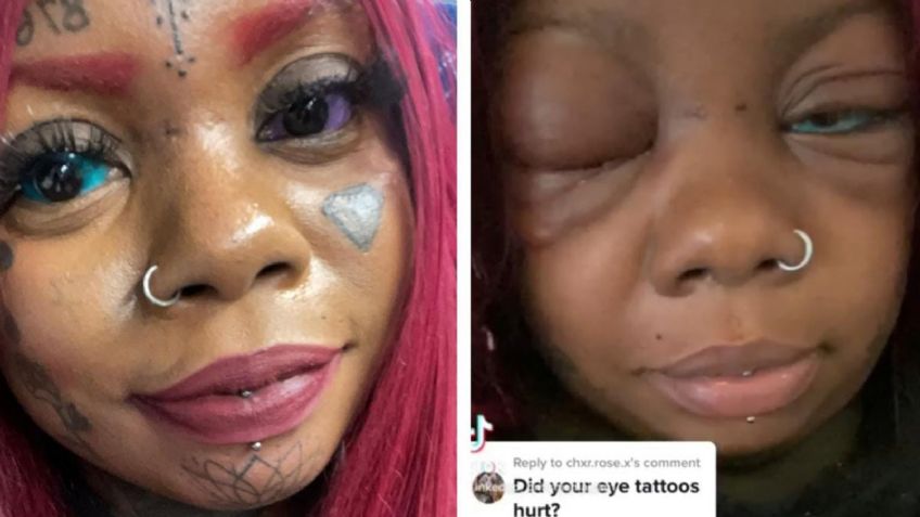 El peligro de tatuarse los ojos, influencers pierden la vista