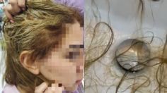 "Me ofrecen una peluca": Mujer muestra entre lágrimas cómo se le cae el cabello tras tratamiento en estética | VIDEO