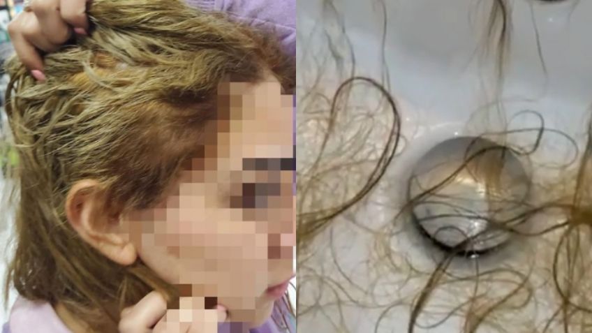 "Me ofrecen una peluca": Mujer muestra entre lágrimas cómo se le cae el cabello tras tratamiento en estética | VIDEO