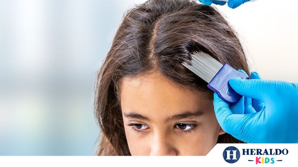 ¿Cómo evitar los pijos en niños? Foto: Especial