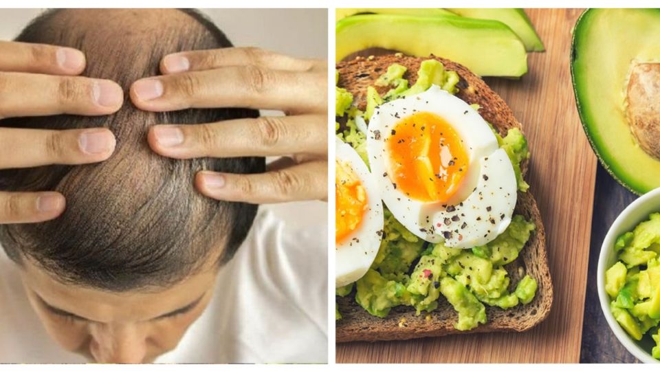 Estos alimentos ayudan a evitar la caída del cabello 
FOTO: Especial