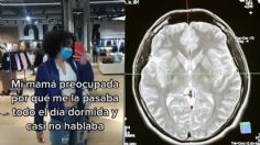 Joven estuvo varios días en cama con un derrame cerebral, su mamá pensó que era una intoxicación | VIDEO