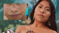 ¿Manchas en la cara? Diles adiós con la rutina de belleza de Yalitza Aparicio