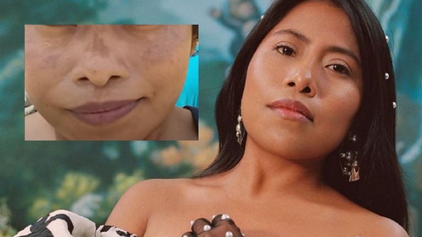 ¿Manchas en la cara? Diles adiós con la rutina de belleza de Yalitza Aparicio