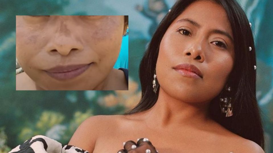 Yalitza Aparicio reveló sus mejores consejos para el cuidado de la piel y para prevenir las manchas en la piel.