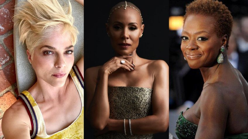 "Tuve impulsos suicidas": Ellas son las famosas que han sufrido con la alopecia como Jada Pinkett