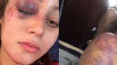 "Estoy cansada de quedarme callada": desgarradora denuncia de una influencer que sufrió golpizas de su exnovio | FOTOS