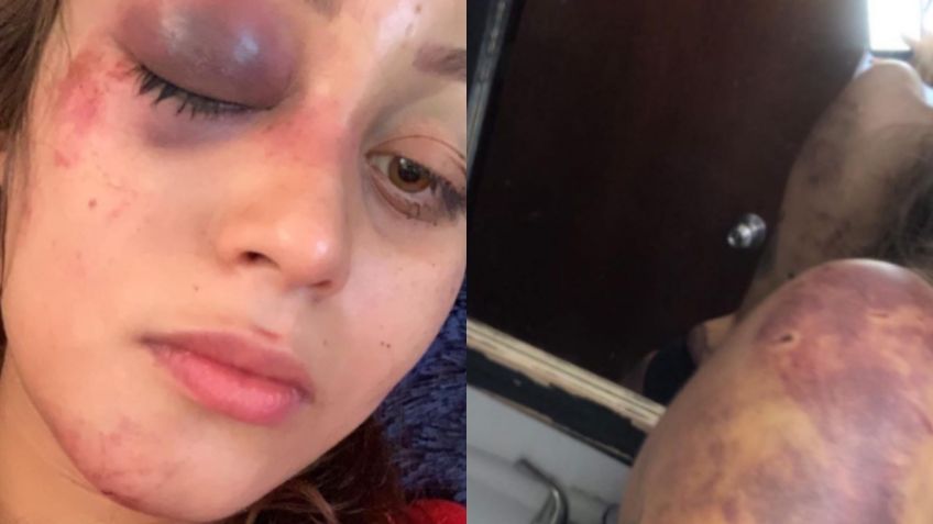 "Estoy cansada de quedarme callada": desgarradora denuncia de una influencer que sufrió golpizas de su exnovio | FOTOS