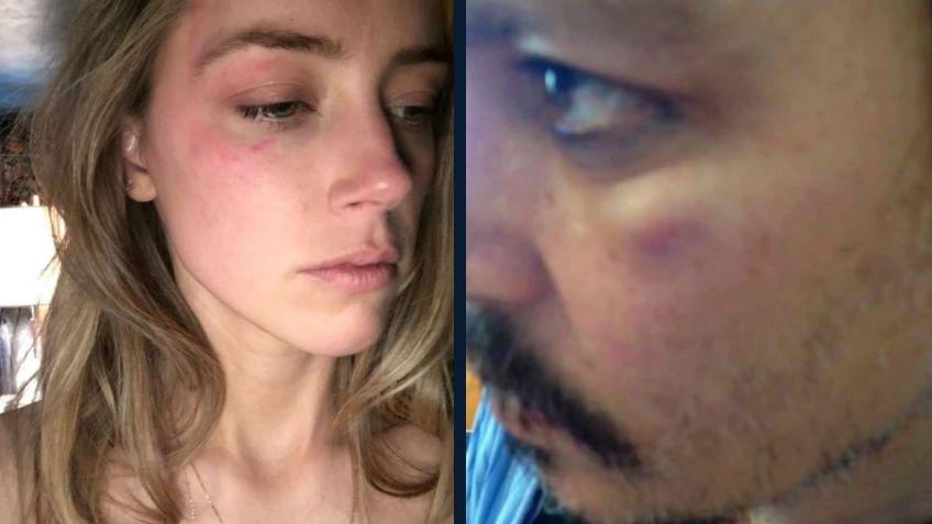 Johnny Depp vs Amber Heard: Estas son las FOTOS que comprueban las agresiones entre la pareja